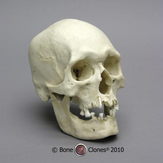 ポリネシア人男性頭蓋骨模型 Bone Style